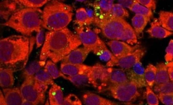 Cientistas avançam na busca por medicamentos capazes de sabotar a replicação do coronavírus